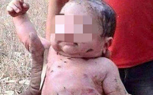 狠心！越南男嬰臍帶未剪遭活埋土堆