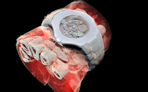 上帝粒子最新癌症檢查應用！3D彩色立體X光片顯像一清二楚