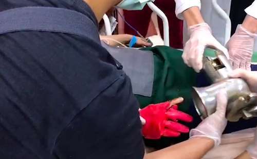 屏東一女手指捲入絞肉機 後送東港安泰醫院搶救(影)