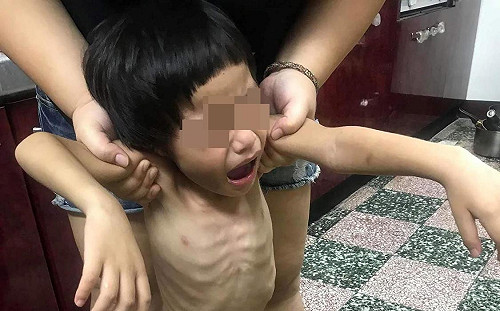 新竹遭虐男童媽媽公開露面：我的小孩不會隨地大小便