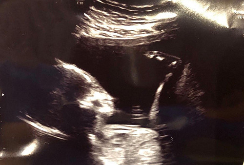 立委洪慈庸有孕了！和卓冠廷在臉書同時冠名宣布喜訊