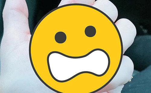 嬌妻指甲剪這樣幫ㄤ抓背 網嚇傻：抓一次就有陰影