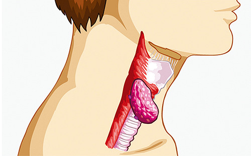 恐怖食道癌奪命  5年存活率低於2成