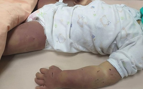 台南虐死1歲女童案 「館長」國罵三字經連發怒飆