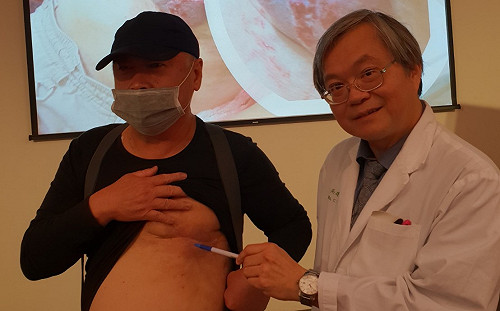 誤將左胸硬塊當胸肌　58歲男子確診罹患乳癌