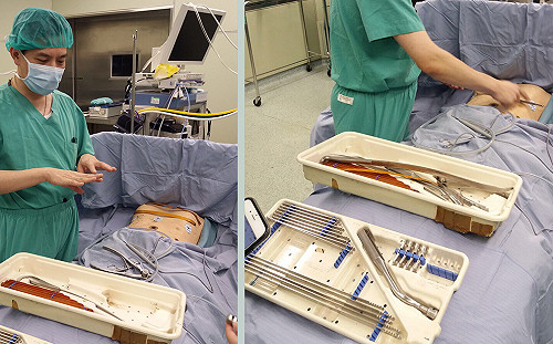 漏斗胸影響身心　微創矯正助改善