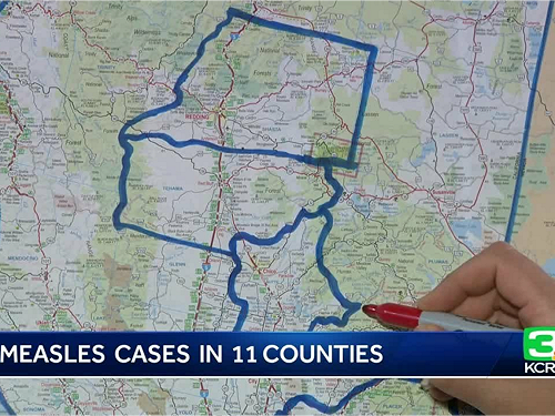 美加州麻疹疫情蔓延 洛杉磯兩大學逾千師生隔離