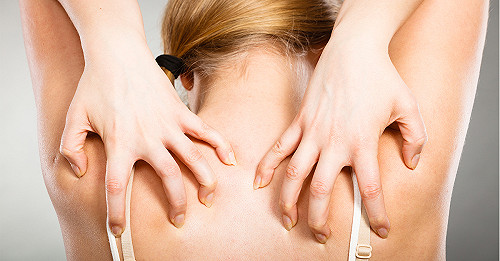 高溫梅雨季體內代謝失調　溼疹　汗皰疹大爆發