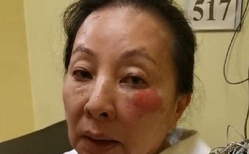 仆街受傷　張花冠：「路不平跌倒」是前縣長的錯