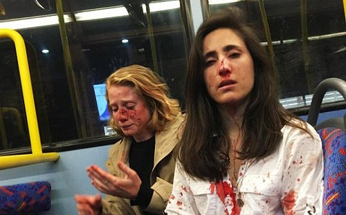 女同志情侶倫敦遭騷擾毆打 英國各界震驚