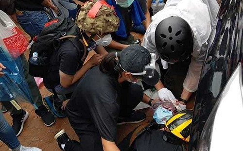 (影)最新》港警「布袋彈」傷人 民眾眼部中彈大量出血