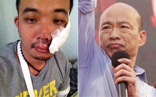 屢遭韓粉霸凌污辱 廣德家老闆PO受傷舊照嘆「內心傷害更多」