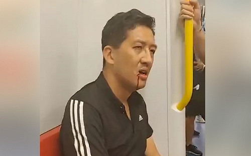 (影)香港元朗衝突遭批警黑合作 港民主黨議員遭白衣人士毆打濺血