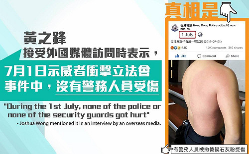 反送中》港警PO紅腫照駁黃之鋒 網友諷「獨立調查還警察公道」