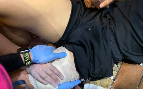 元朗14歲中槍少年  遭控參與暴動和襲警被逮