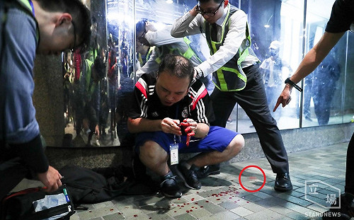 反送中》反暴警示威濺血 香港區議員遭襲咬斷耳朵