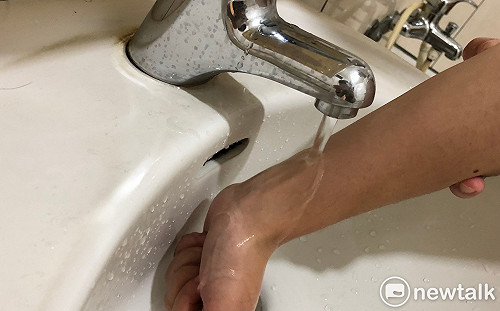 燙傷別再誤信偏方了！謹記「沖脫泡蓋送」5原則