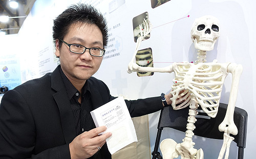 骨折不用二次開刀受苦！「可降解性內固紗布」可取代骨釘