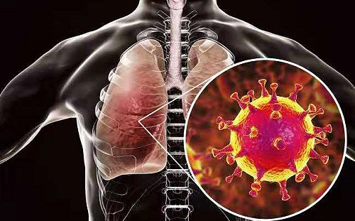 武漢肺炎美首兩例基因定序完成 CDC:未變種