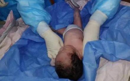 武漢肺炎》哈爾濱確診病例生產 小女嬰沒在娘胎被感染