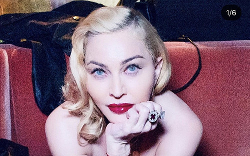 武漢肺炎》瑪丹娜承認染疫！4月巴黎巡演同台表演者全生病