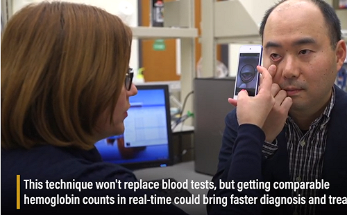 美國團隊研發醫療APP  拍下眼瞼可準確測量貧血