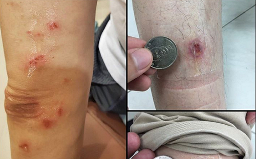 陳以信皮開肉綻？郭國文秀自己慘狀