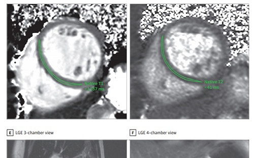 武漢肺炎新藥瑞德西韋美國買走50萬劑 全台只剩78劑