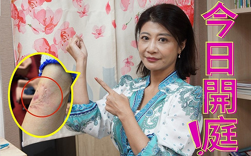 藍委涉咬人》林楚茵秀2個月咬痕 賴品妤驚：屍毒很深