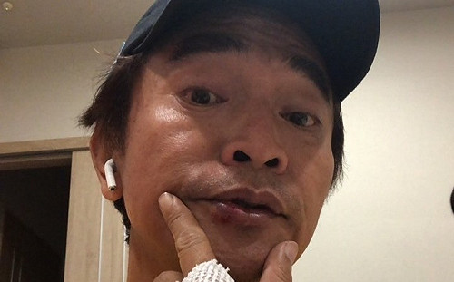 憲哥錄節目摔車受傷！貼出7秒驚險畫面報平安