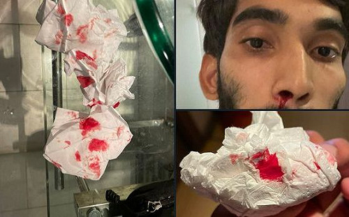 「疫」外！前球王不滿檢測被捅出血