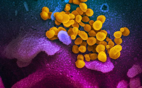 抗體失效全球首例?巴西男二度染變種新冠病毒  病情迅速惡化身亡