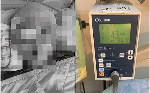 集氣!台中童學柔道腦死 腦壓「120降到43」父約定康復後一起去滑草
