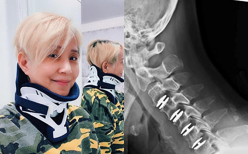 開刀多花23萬李明依怒轟!林智群律師回敬「國家唯一做錯的事」