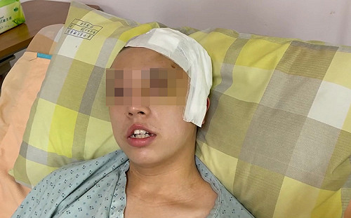 擦撞瑪莎拉蒂遭毆重傷案 男大生轉普通病房 感謝稱「會好好加油」