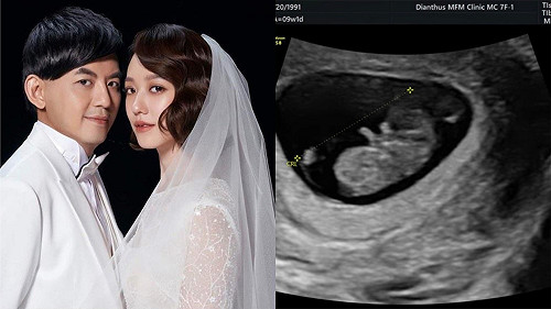 黃子佼更正寶寶小名「不叫玉米或黃瓜」！孟耿如秒打臉：就是要啊