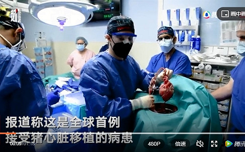 全球首例! 人類首次成功接受轉基因豬心臟移植