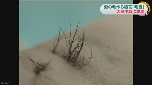 生髮新技術成功！大量培植毛囊細胞可行