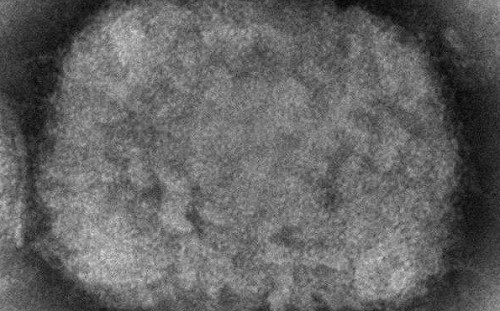 猴痘監測範圍擴大 世衛：確診個案料進一步增加