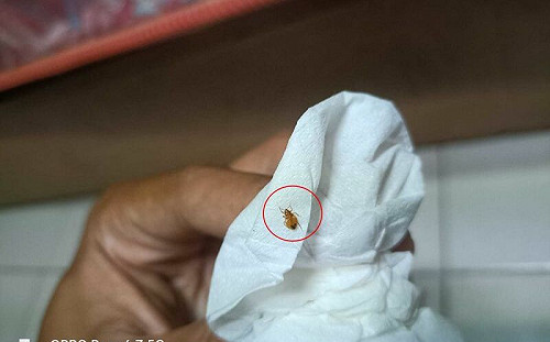 床上怪蟲殺不完！真面目比蟑螂可怕