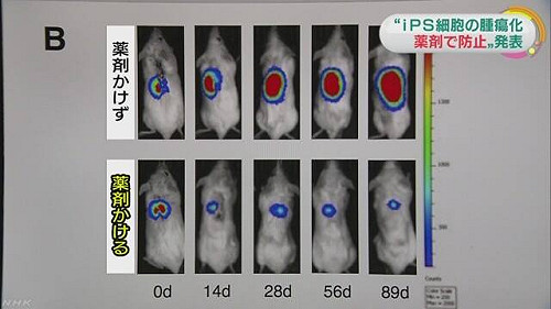 日發現特殊藥劑可防止iPS細胞移植腫瘤化