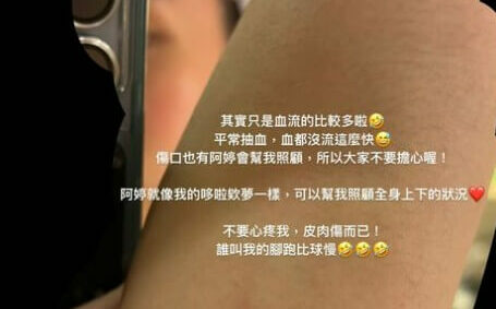 受傷不是輸球藉口  戴資穎IG秀傷口要大家別擔心