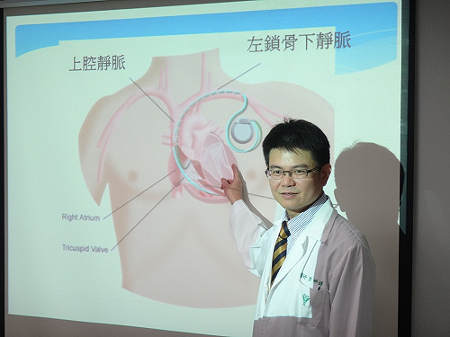 心臟也會沒電？醫師提醒退化易影響心跳