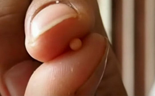 花5百吃烤鳳螺！泰男咬到珍珠之王