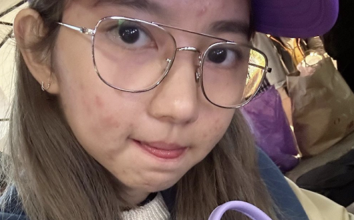 退賽《全明星》近況曝光！林玉書「滿臉痘」網驚：車禍現場