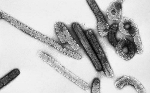 無藥可醫！馬堡病毒現蹤非洲坦桑尼亞至少5死