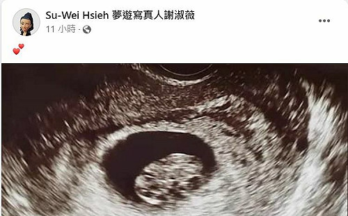 恭喜懷孕？謝淑薇復出前突傳喜訊