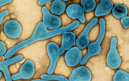 赤道幾內亞馬堡病毒疫情擴散！疾管署：旅遊疫情建議等級提升 