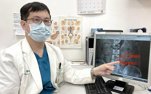 40多歲男子尿不出來  竟是「結石」卡尿管！專科醫曝療程