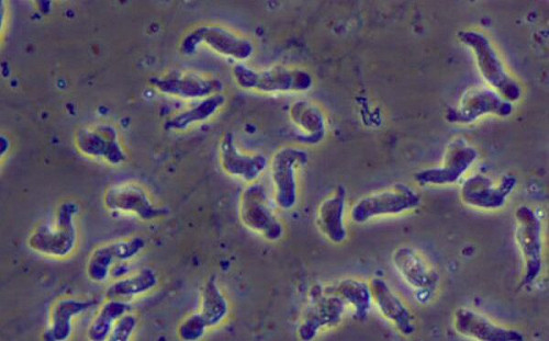 北部女玩水染食腦變形蟲亡！衛生局曝最新疫調：只去新北一處親水設施
